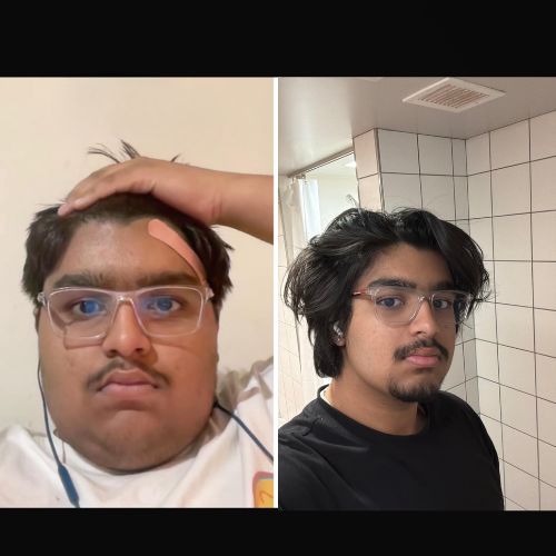 transformation